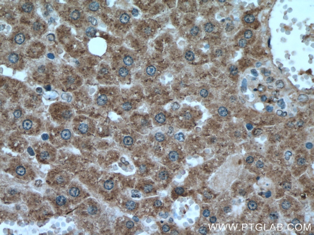 Immunohistochemistry (IHC) staining of rat liver tissue using HACL1 Polyclonal antibody (15519-1-AP)