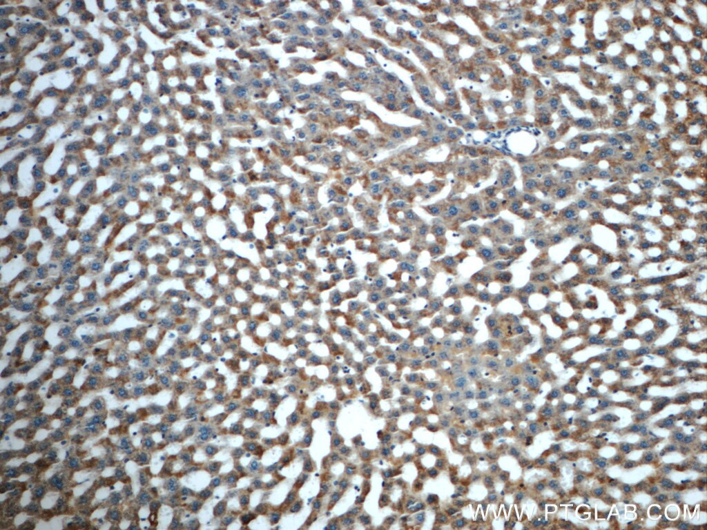 Immunohistochemistry (IHC) staining of rat liver tissue using HACL1 Polyclonal antibody (15519-1-AP)