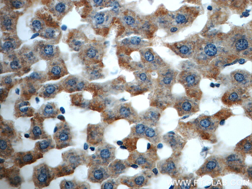 Immunohistochemistry (IHC) staining of rat liver tissue using HACL1 Polyclonal antibody (15519-1-AP)