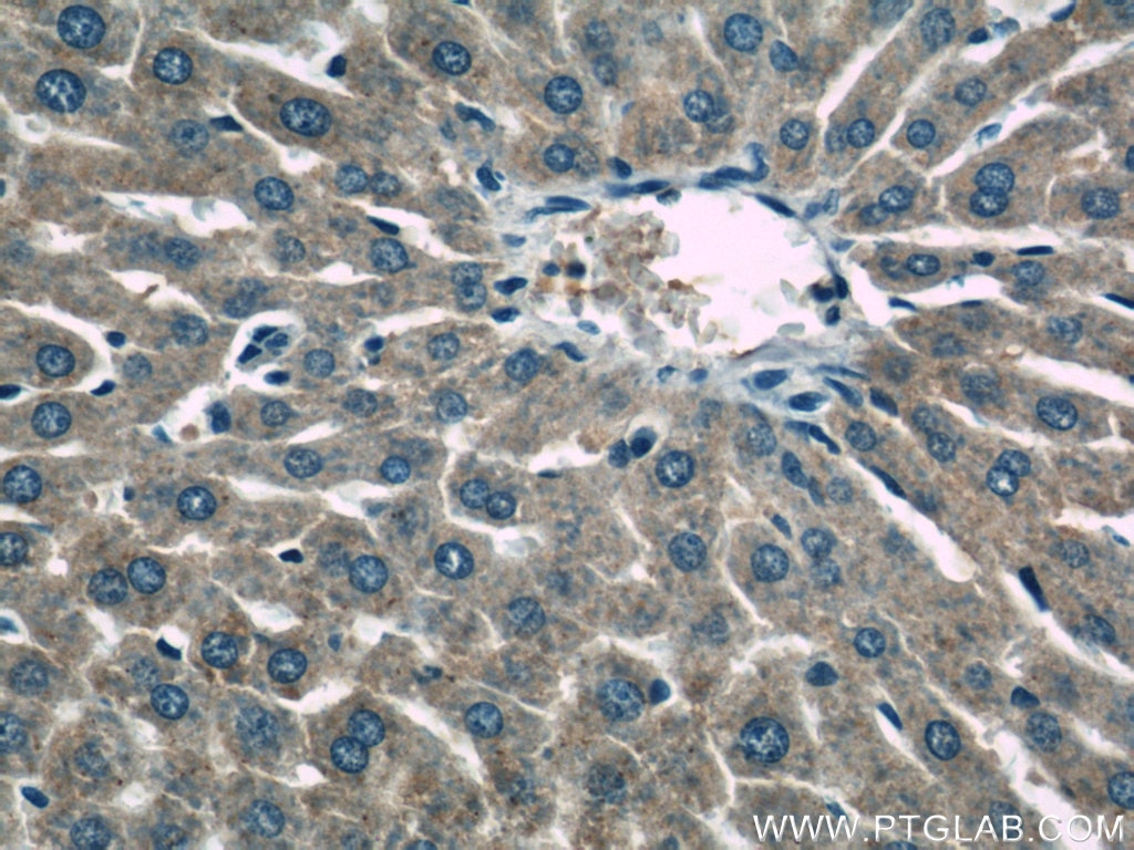 Immunohistochemistry (IHC) staining of rat liver tissue using HACL1 Polyclonal antibody (15519-1-AP)