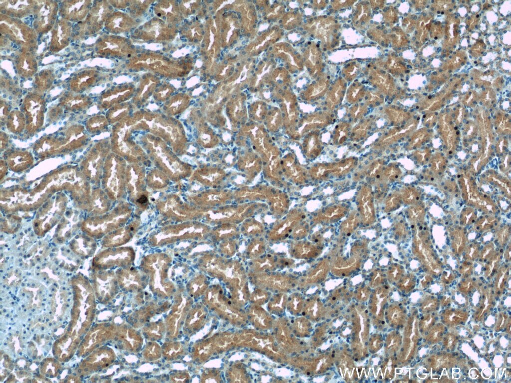 Immunohistochemistry (IHC) staining of rat kidney tissue using HACL1 Polyclonal antibody (15519-1-AP)