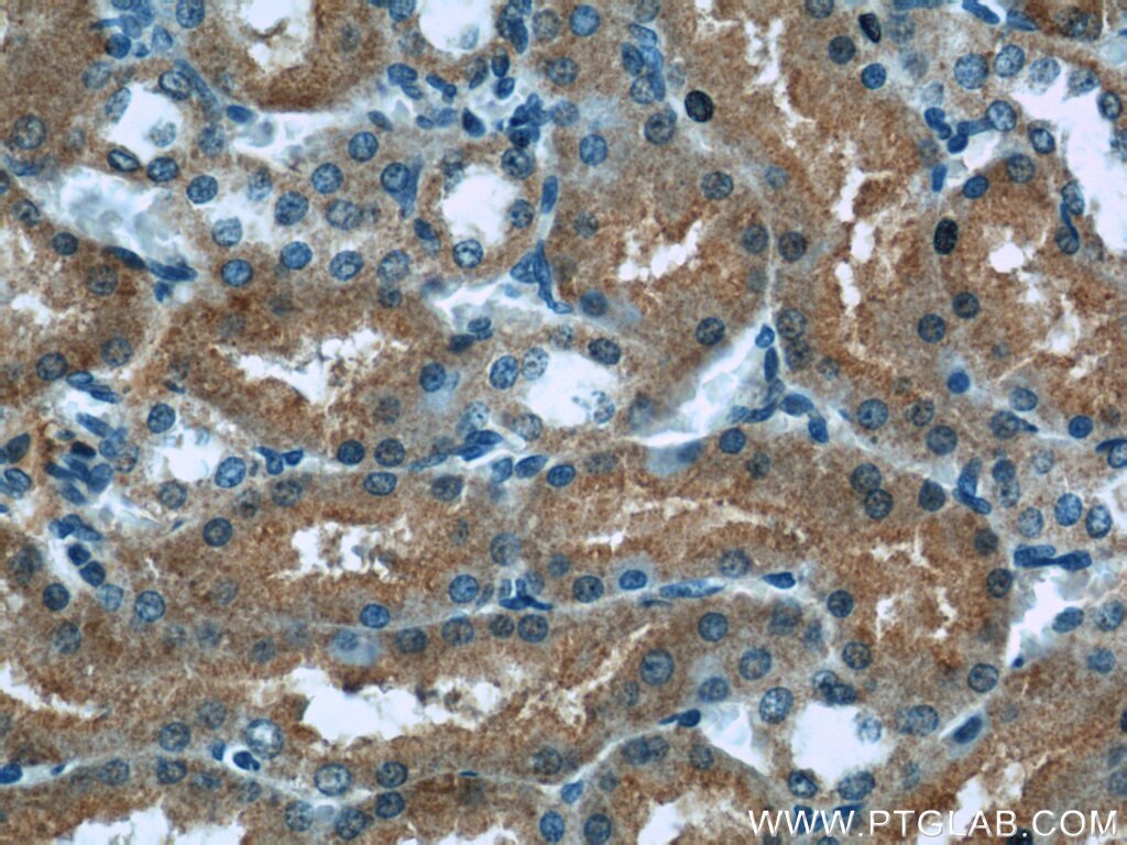 Immunohistochemistry (IHC) staining of rat kidney tissue using HACL1 Polyclonal antibody (15519-1-AP)