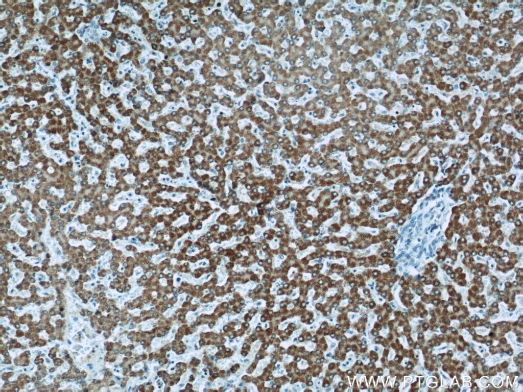 Immunohistochemistry (IHC) staining of human liver tissue using HACL1 Polyclonal antibody (15519-1-AP)