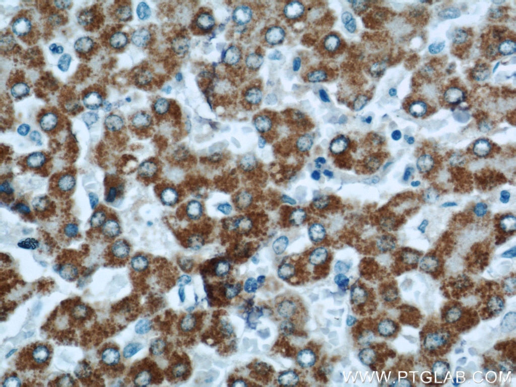 Immunohistochemistry (IHC) staining of human liver tissue using HACL1 Polyclonal antibody (15519-1-AP)