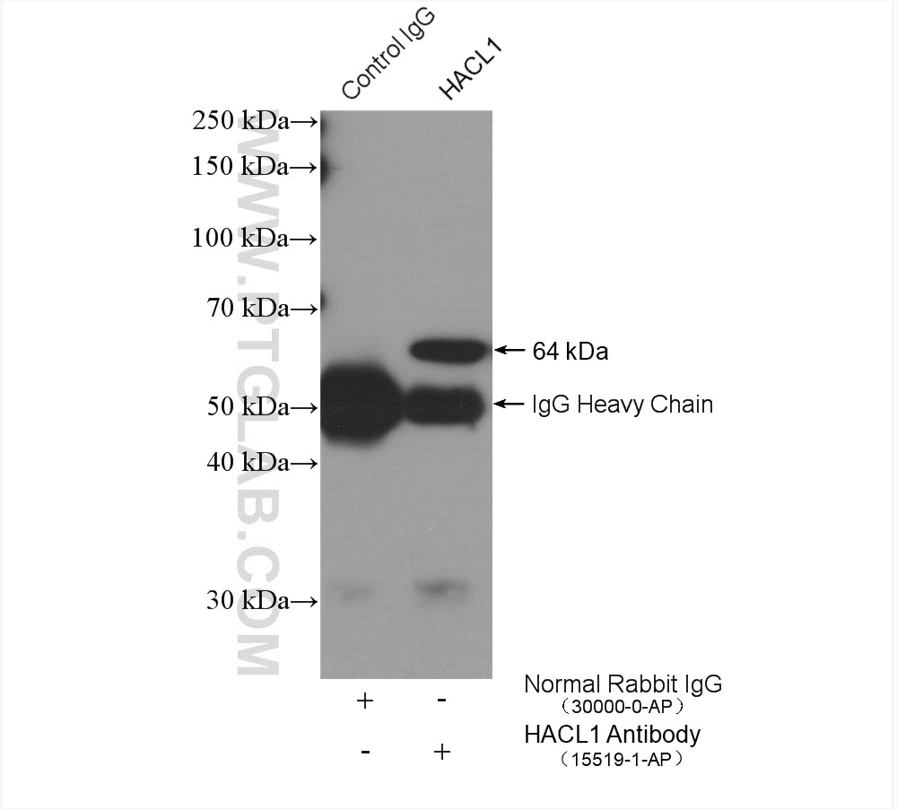 Immunoprecipitation (IP) experiment of HeLa cells using HACL1 Polyclonal antibody (15519-1-AP)