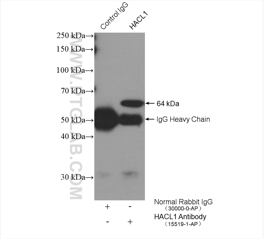 IP experiment of HeLa using 15519-1-AP