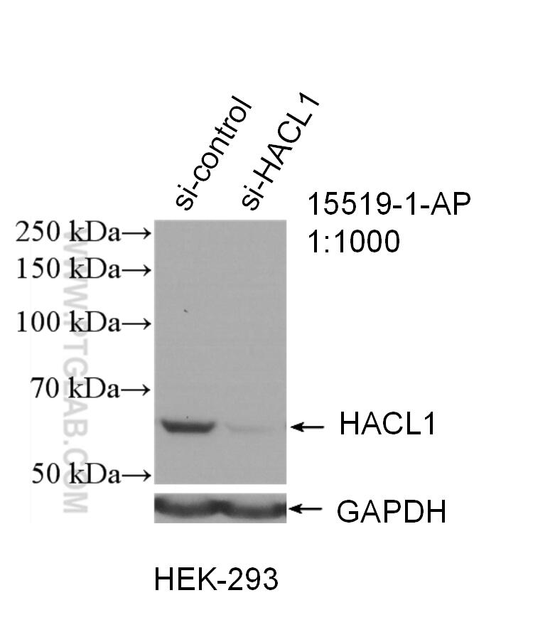 Western Blot (WB) analysis of HEK-293 cells using HACL1 Polyclonal antibody (15519-1-AP)