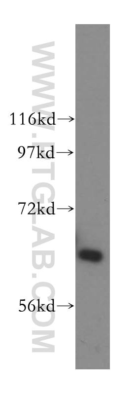 Western Blot (WB) analysis of HEK-293 cells using HACL1 Polyclonal antibody (15519-1-AP)