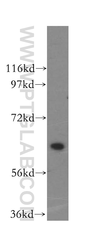 Western Blot (WB) analysis of HeLa cells using HACL1 Polyclonal antibody (15519-1-AP)