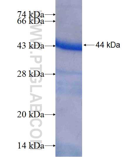 HACL1 fusion protein Ag7757 SDS-PAGE