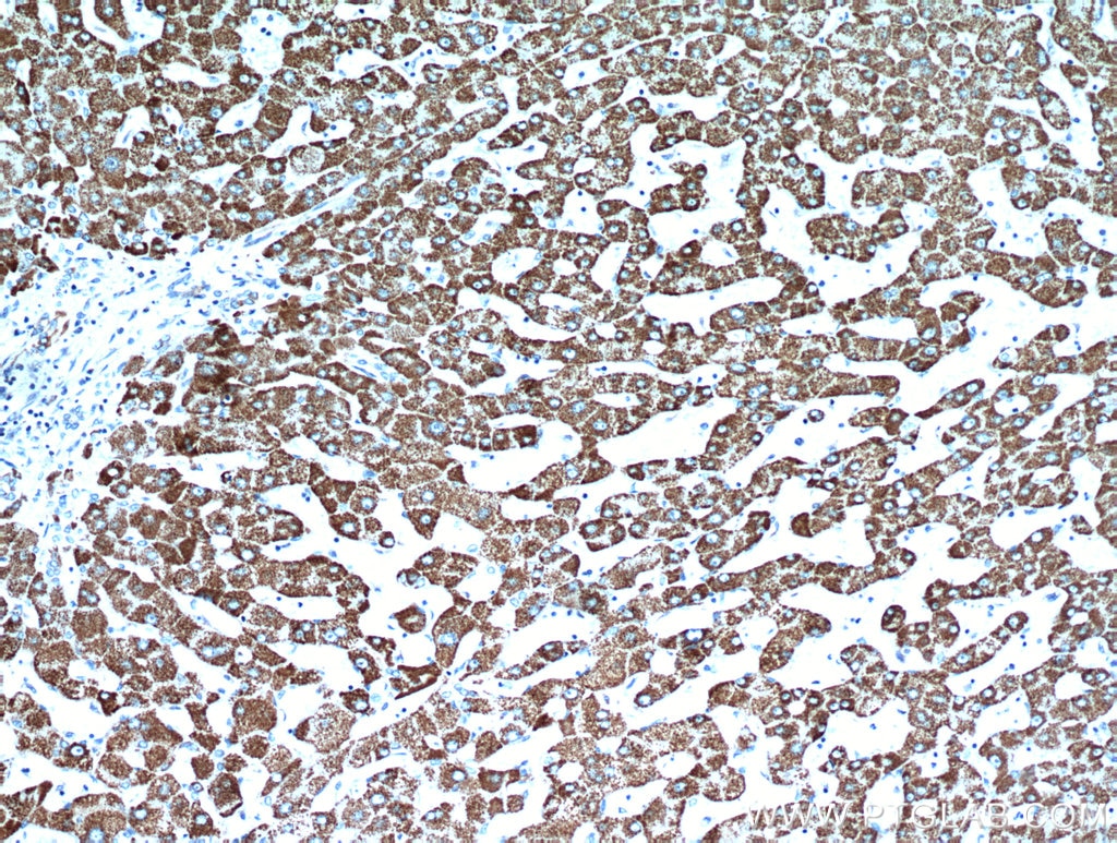 Immunohistochemistry (IHC) staining of human hepatocirrhosis tissue using HADH Polyclonal antibody (19828-1-AP)