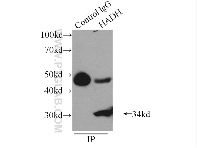 Immunoprecipitation (IP) experiment of HepG2 cells using HADH Polyclonal antibody (19828-1-AP)