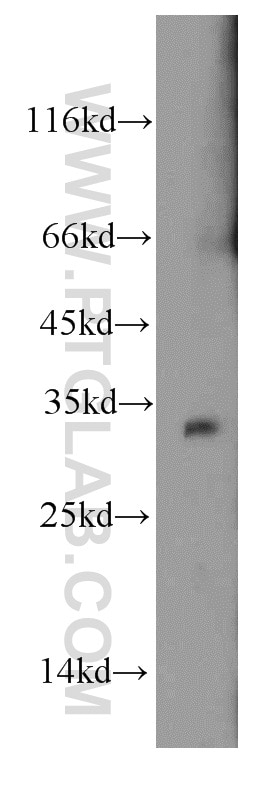 Western Blot (WB) analysis of mouse skeletal muscle tissue using HADH Polyclonal antibody (19828-1-AP)