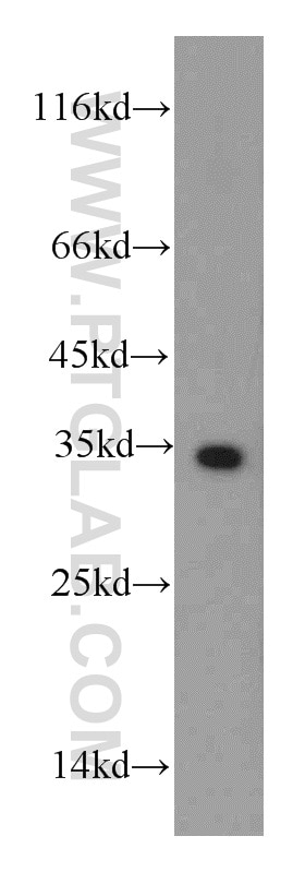 Western Blot (WB) analysis of Jurkat cells using HADH Polyclonal antibody (19828-1-AP)