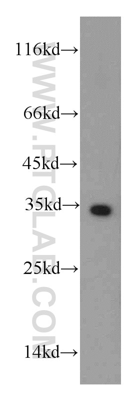 WB analysis of Jurkat using 19828-1-AP