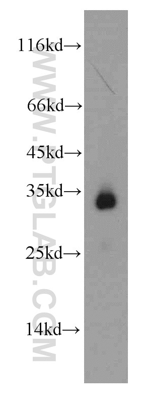 Western Blot (WB) analysis of mouse heart tissue using HADH Polyclonal antibody (19828-1-AP)