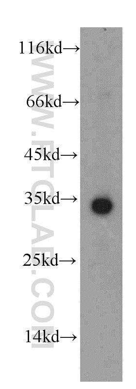 WB analysis of mouse kidney using 19828-1-AP