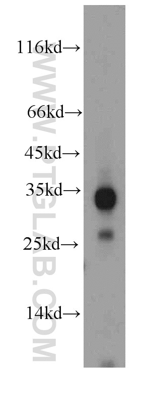 Western Blot (WB) analysis of mouse liver tissue using HADH Polyclonal antibody (19828-1-AP)