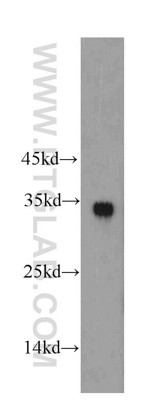 Western Blot (WB) analysis of mouse pancreas tissue using HADH Polyclonal antibody (19828-1-AP)
