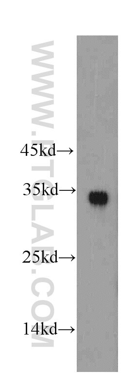 WB analysis of mouse pancreas using 19828-1-AP