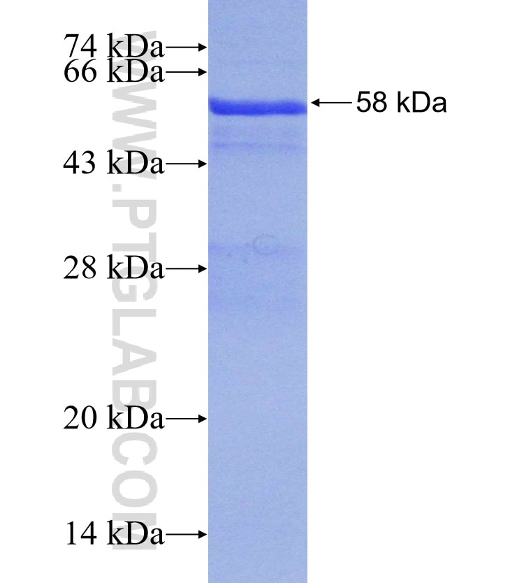 HADH fusion protein Ag13928 SDS-PAGE