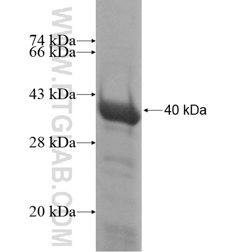 HADH fusion protein Ag13976 SDS-PAGE