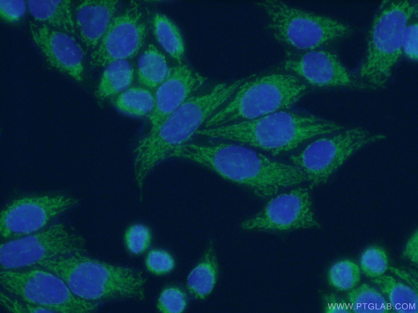 Immunofluorescence (IF) / fluorescent staining of HeLa cells using HADHA Polyclonal antibody (10758-1-AP)