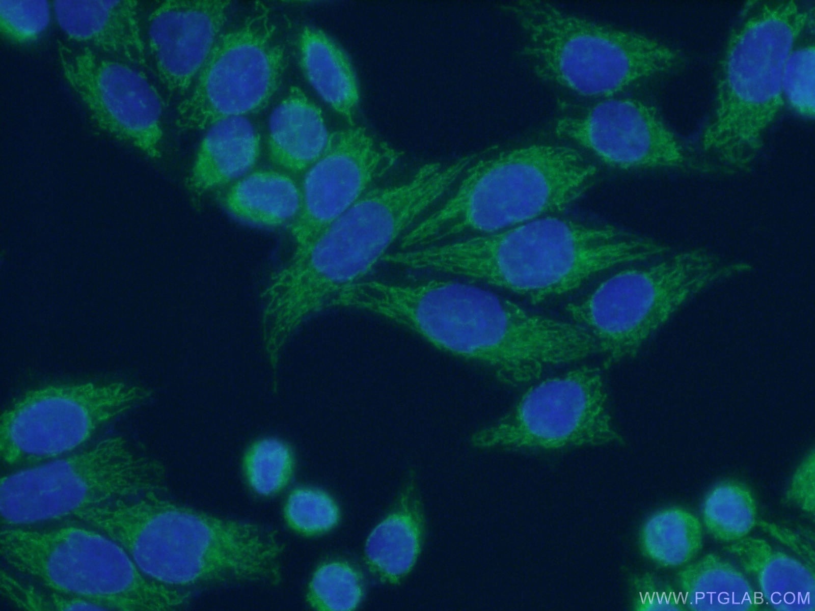 IF Staining of HeLa using 10758-1-AP