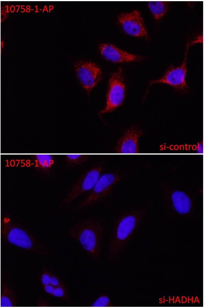 Immunofluorescence (IF) / fluorescent staining of HeLa cells using HADHA Polyclonal antibody (10758-1-AP)