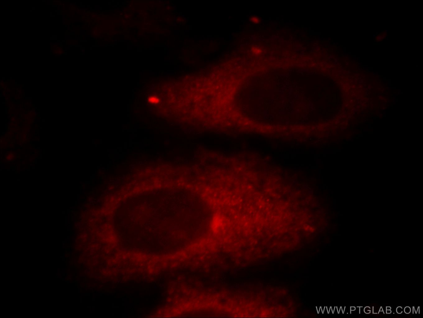 Immunofluorescence (IF) / fluorescent staining of HepG2 cells using HADHA Polyclonal antibody (10758-1-AP)