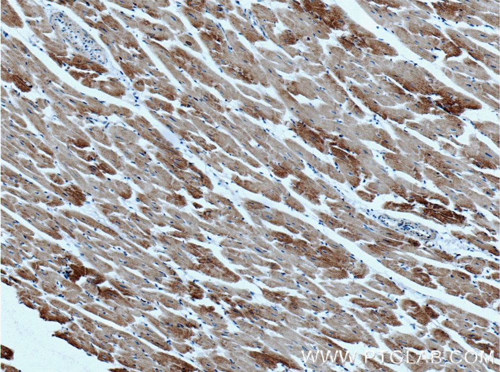 Immunohistochemistry (IHC) staining of human heart tissue using HADHA Polyclonal antibody (10758-1-AP)