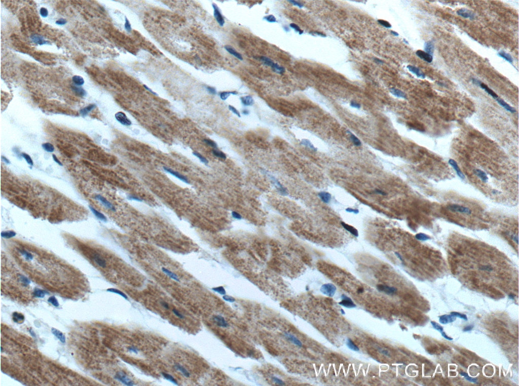 Immunohistochemistry (IHC) staining of human heart tissue using HADHA Polyclonal antibody (10758-1-AP)