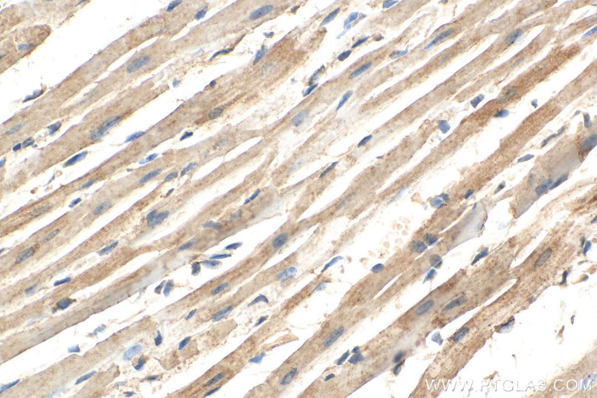 Immunohistochemistry (IHC) staining of mouse heart tissue using HADHA Polyclonal antibody (10758-1-AP)