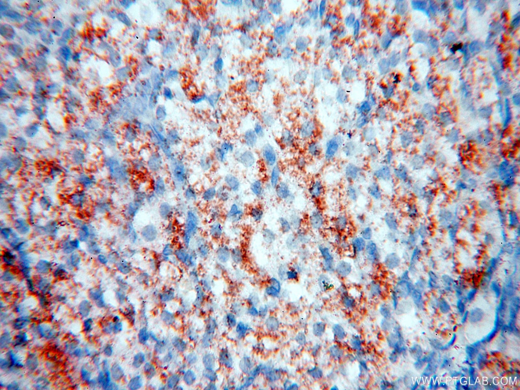 Immunohistochemistry (IHC) staining of human ovary tissue using HADHA Polyclonal antibody (10758-1-AP)