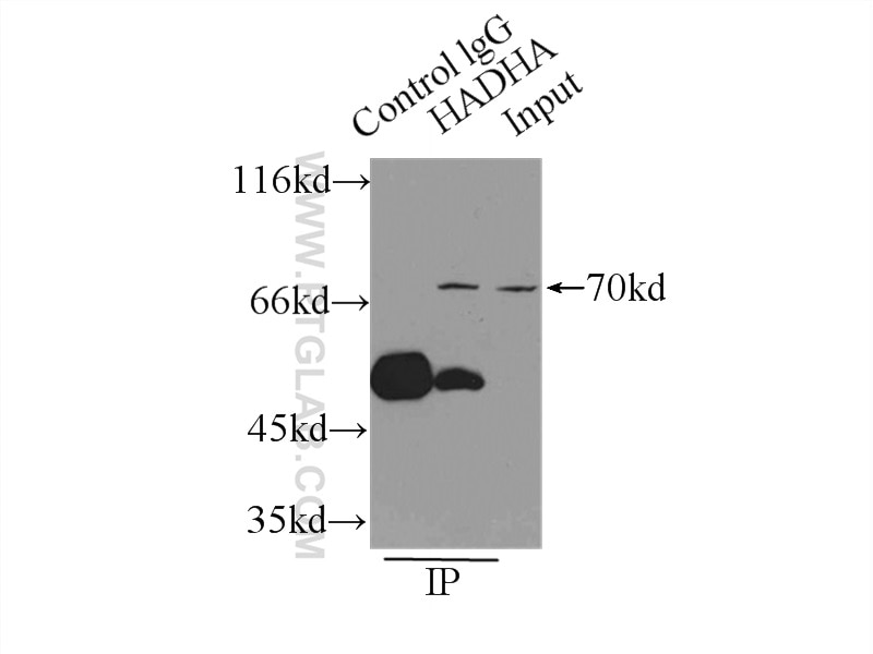 Immunoprecipitation (IP) experiment of HEK-293 cells using HADHA Polyclonal antibody (10758-1-AP)