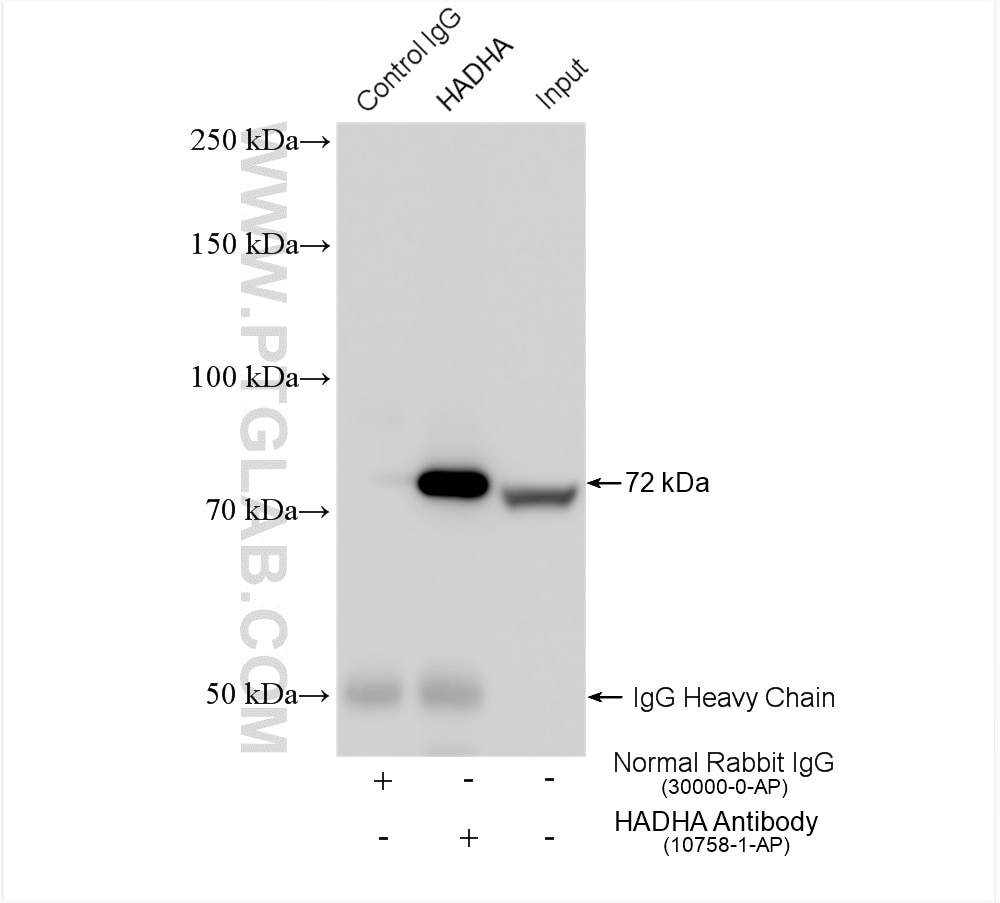 Immunoprecipitation (IP) experiment of HeLa cells using HADHA Polyclonal antibody (10758-1-AP)