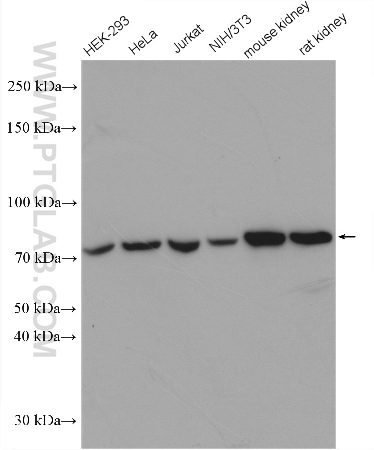 Western Blot (WB) analysis of various lysates using HADHA Polyclonal antibody (10758-1-AP)