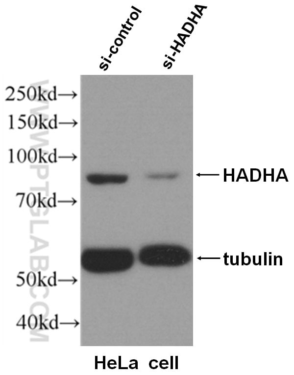 Western Blot (WB) analysis of HeLa cells using HADHA Polyclonal antibody (10758-1-AP)