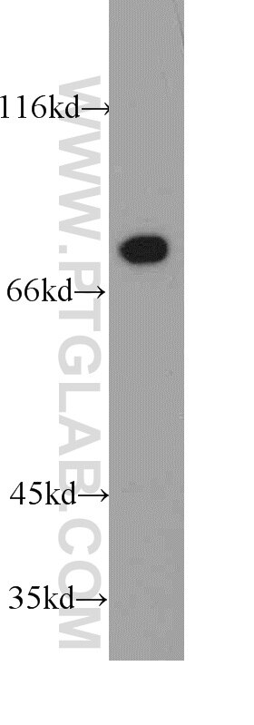 Western Blot (WB) analysis of MCF-7 cells using HADHA Polyclonal antibody (10758-1-AP)