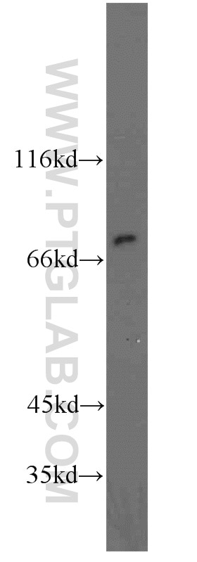 Western Blot (WB) analysis of HepG2 cells using HADHA Polyclonal antibody (10758-1-AP)