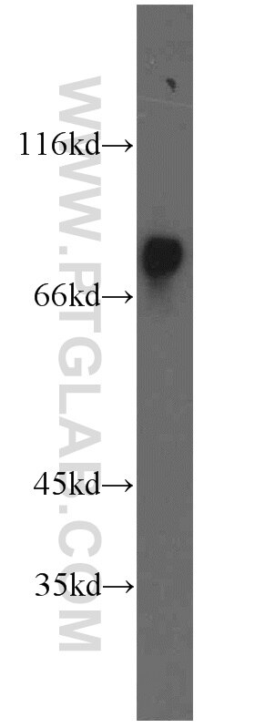 Western Blot (WB) analysis of mouse heart tissue using HADHA Polyclonal antibody (10758-1-AP)