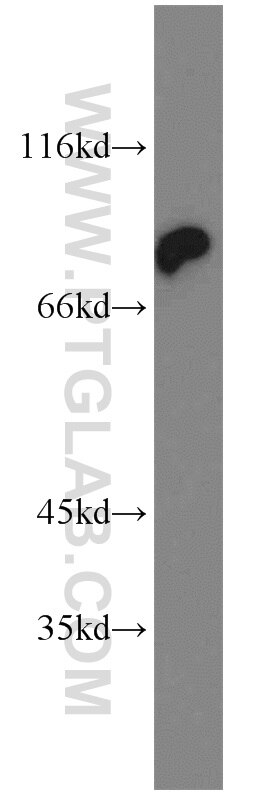 Western Blot (WB) analysis of mouse liver tissue using HADHA Polyclonal antibody (10758-1-AP)
