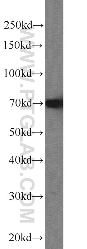 Western Blot (WB) analysis of HEK-293 cells using HADHA Polyclonal antibody (10758-1-AP)
