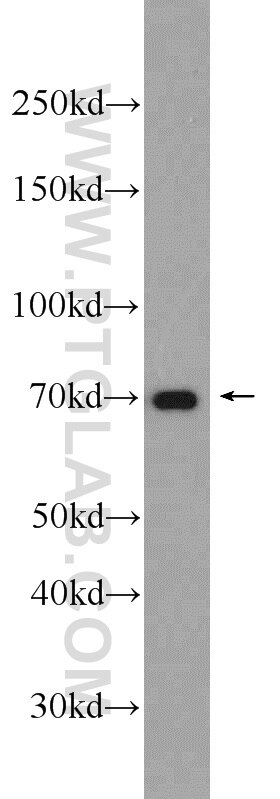 Western Blot (WB) analysis of HeLa cells using HADHA Polyclonal antibody (10758-1-AP)