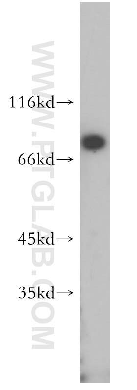 Western Blot (WB) analysis of MDA-MB-453s cells using HADHA Polyclonal antibody (10758-1-AP)