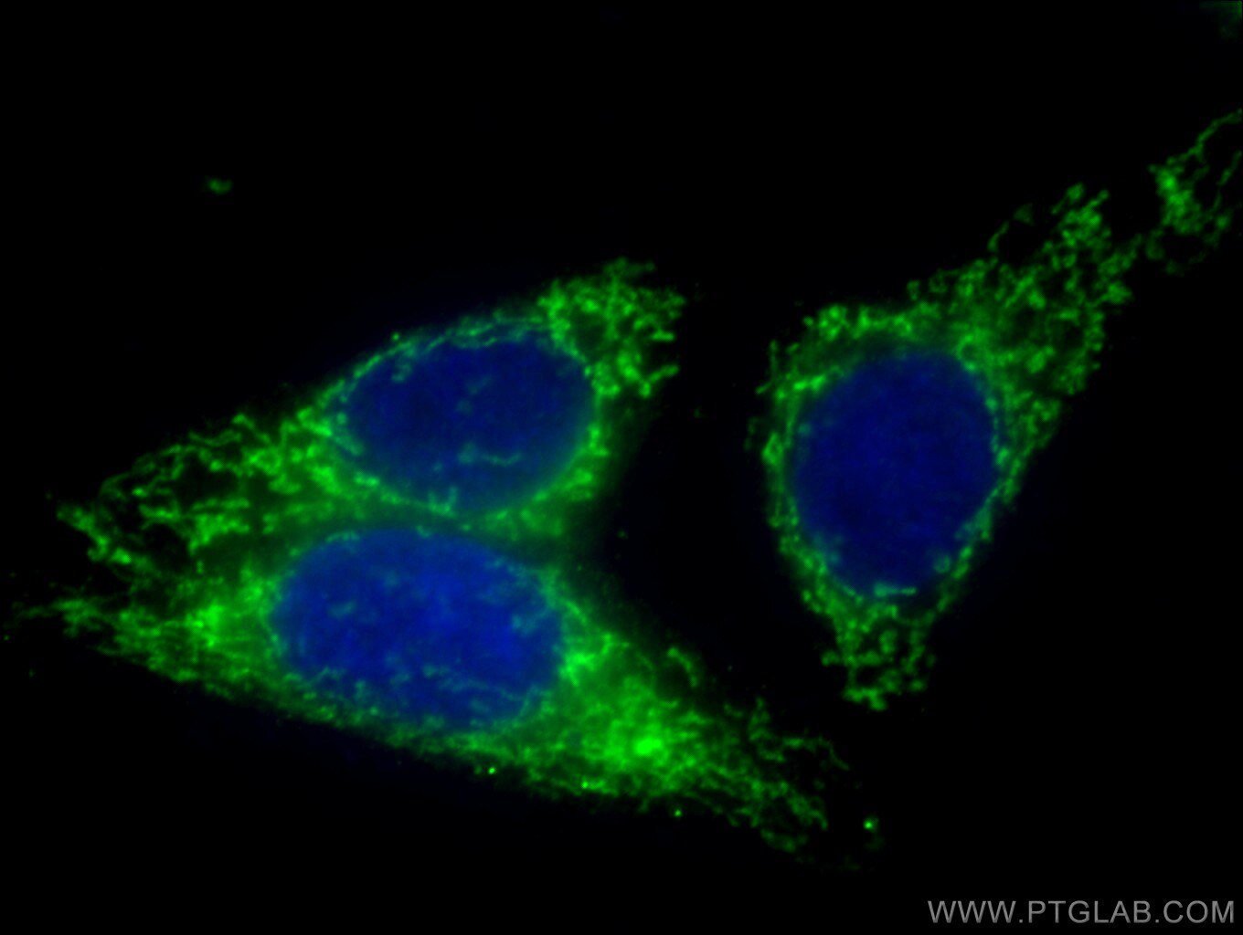 Immunofluorescence (IF) / fluorescent staining of HepG2 cells using HADHA Monoclonal antibody (60250-1-Ig)