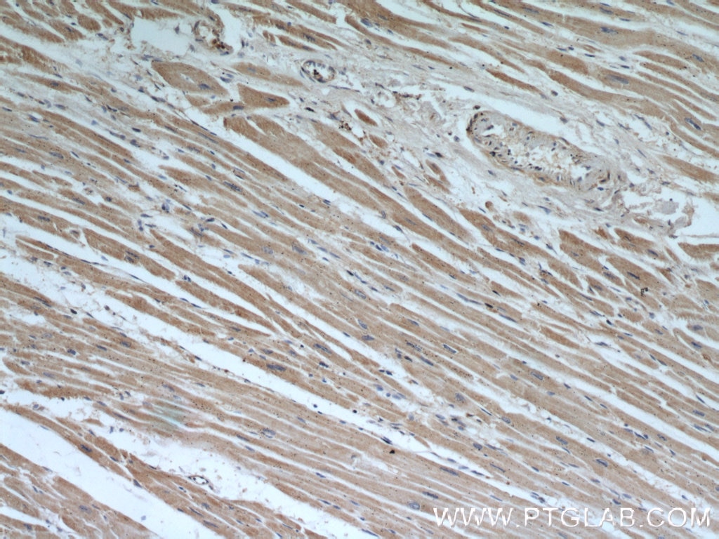 Immunohistochemistry (IHC) staining of human heart tissue using HADHA Monoclonal antibody (60250-1-Ig)