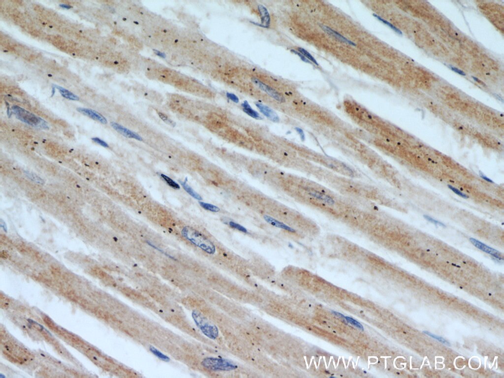 Immunohistochemistry (IHC) staining of human heart tissue using HADHA Monoclonal antibody (60250-1-Ig)