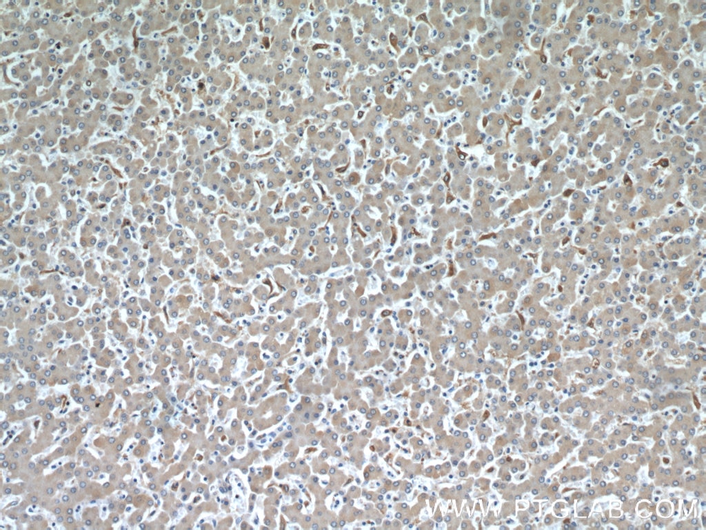 Immunohistochemistry (IHC) staining of human liver tissue using HADHA Monoclonal antibody (60250-1-Ig)