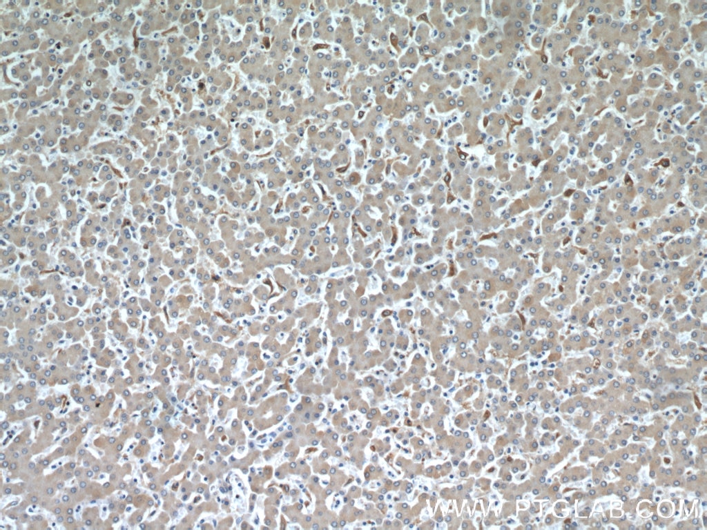 Immunohistochemistry (IHC) staining of human liver tissue using HADHA Monoclonal antibody (60250-1-Ig)